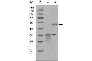 Western blot analysis using Mammaglobin-1 mouse mAb against full-length GST- Mammaglobin-1 (1) and full-length MBP- Mammaglobin-1 (aa1-193) recombinant protein (2).