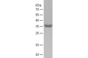 Western Blotting (WB) image for Mitogen-Activated Protein Kinase Kinase 4 (MAP2K4) (AA 1-144) protein (His-IF2DI Tag) (ABIN7283917) (MAP2K4 Protein (AA 1-144) (His-IF2DI Tag))