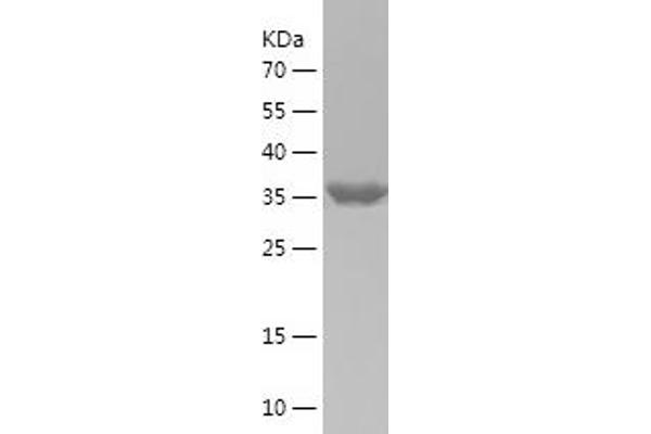 MAP2K4 Protein (AA 1-144) (His-IF2DI Tag)