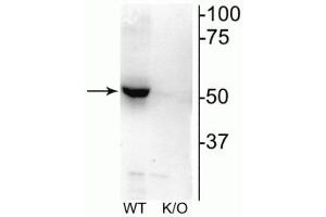 Western blot of mouse habenula lysate showing specific immunolabeling of the ~52 kDa nAChRβ2 protein. (CHRNB2 antibody  (Cytoplasmic Loop))