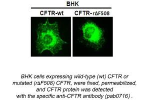 Image no. 1 for anti-Cystic Fibrosis Transmembrane Conductance Regulator (ATP-Binding Cassette Sub-Family C, Member 7) (CFTR) (N-Term) antibody (ABIN559719) (CFTR antibody  (N-Term))