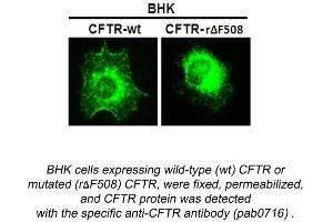 Image no. 1 for anti-Cystic Fibrosis Transmembrane Conductance Regulator (ATP-Binding Cassette Sub-Family C, Member 7) (CFTR) (N-Term) antibody (ABIN559718) (CFTR antibody  (N-Term))