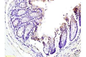 Formalin-fixed and paraffin embedded mouse colon tissue labeled with Anti-TNFSF18 Polyclonal Antibody, Unconjugated  at 1:200 followed by conjugation to the secondary antibody and DAB staining (TNFSF18 antibody  (AA 101-199))