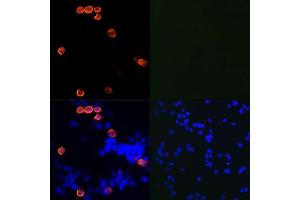 Immunofluorescence analysis of 293T cells transfected with SARS-Cov-2 3CLpro and untreated 293T cells using SARS-CoV-2 3CLpro Rabbit mAb (ABIN7270150) at dilution of 1:100/1:400/1:800(40x lens).