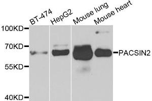 Western blot analysis of extracts of various cells, using PACSIN2 antibody. (PACSIN2 antibody)