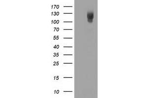 Western Blotting (WB) image for anti-phosphodiesterase 2A, CGMP-Stimulated (PDE2A) antibody (ABIN1500078)