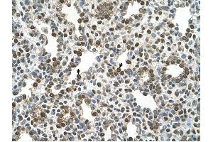 OSBPL9 antibody was used for immunohistochemistry at a concentration of 4-8 ug/ml to stain Alveolar cells (arrows) in Human Lung.