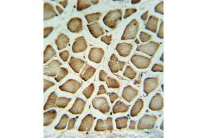 FIBG Antibody (C-term) (ABIN390507 and ABIN2840862) IHC analysis in formalin fixed and paraffin embedded human skeletal muscle tissue followed by peroxidase conjugation of the secondary antibody and DAB staining. (FGG antibody  (C-Term))