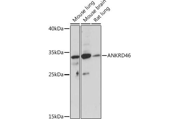ANKRD46 antibody
