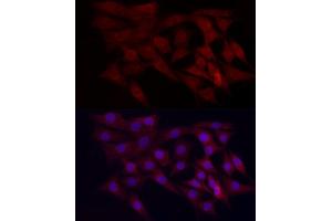 Immunofluorescence analysis of NIH/3T3 cells using WDR45 Rabbit pAb (ABIN6133064, ABIN6150194, ABIN6150195 and ABIN6223490) at dilution of 1:100 (40x lens).