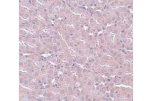 Immunohistochemistry (IHC) image for anti-FERM and PDZ Domain Containing 2 (FRMPD2) (N-Term) antibody (ABIN1031387)