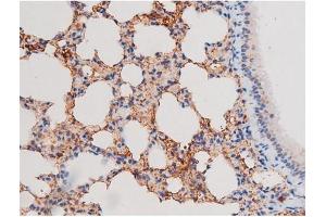 Immunohistochemistry (IHC) image for anti-Insulin Receptor Substrate 1 (IRS1) (pSer636) antibody (ABIN6255436)
