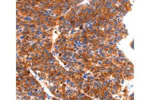Immunohistochemistry (IHC) image for anti-Septin 4 (SEPT4) antibody (ABIN2432617) (Septin 4 antibody)