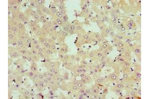 Immunohistochemistry of paraffin-embedded human liver tissue using ABIN7168990 at dilution of 1:100 (STK3 antibody  (AA 323-450))