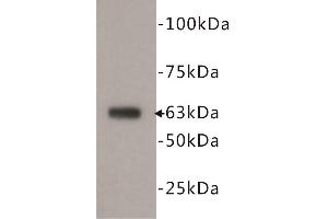 Western Blotting (WB) image for anti-5'-Nucleotidase, Ecto (CD73) (NT5E) antibody (ABIN1854862) (CD73 antibody)