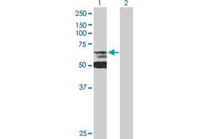 Western Blot analysis of LBR expression in transfected 293T cell line by LBR MaxPab polyclonal antibody.