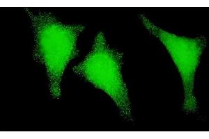 Immunofluorescence of monoclonal antibody to STAU1 on HeLa cell.