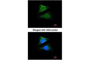 ICC/IF Image Immunofluorescence analysis of paraformaldehyde-fixed HeLa, using Seladin 1, antibody at 1:200 dilution. (Seladin 1 antibody)