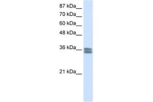 Western Blotting (WB) image for anti-Calcium Channel, Voltage-Dependent, gamma Subunit 4 (CACNG4) antibody (ABIN2461575)