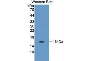 Western Blotting (WB) image for Glutamate Decarboxylase 1 (Brain, 67kDa) (GAD1) ELISA Kit (ABIN6574313)