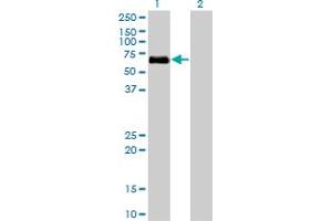 Western Blot analysis of BMPR1A expression in transfected 293T cell line by BMPR1A monoclonal antibody (M01), clone 4C4.