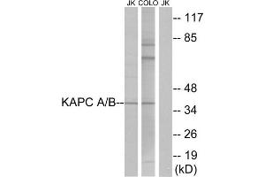 Western Blotting (WB) image for anti-KAPC A/B (N-Term) antibody (ABIN1849204) (KAPC A/B (N-Term) antibody)