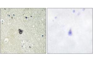 Immunohistochemistry analysis of paraffin-embedded human brain tissue, using CSFR (Ab-809) Antibody. (CSF1R antibody  (AA 781-830))