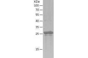 Western Blotting (WB) image for Transcription Factor AP-2 alpha (Activating Enhancer Binding Protein 2 Alpha) (TFAP2A) (AA 213-437) protein (His tag) (ABIN7282904) (TFAP2A Protein (AA 213-437) (His tag))
