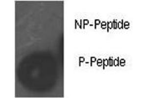 Dot blot analysis of phospho-Rb antibody. (Retinoblastoma Protein (Rb) antibody  (pSer780))