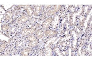 Detection of DTYMK in Porcine Kidney Tissue using Monoclonal Antibody to Deoxythymidylate Kinase (DTYMK) (DTYMK antibody  (AA 43-190))