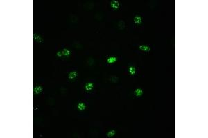 Immunofluorescence staining of A549 cells(treated with 100 ng/mL EGF for 20 min) with ABIN7127690 at 1:100,counter-stained with DAPI. (Recombinant EIF2S1 antibody  (pSer51))