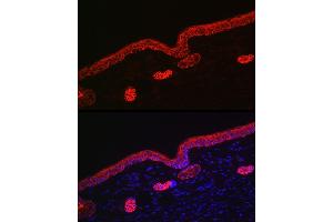 Immunofluorescence analysis of rat skin using Cytokeratin 16 (KRT16) Rabbit pAb (ABIN6129541, ABIN6143021, ABIN6143022 and ABIN6223391) at dilution of 1:200 (40x lens). (KRT16 antibody  (AA 190-430))