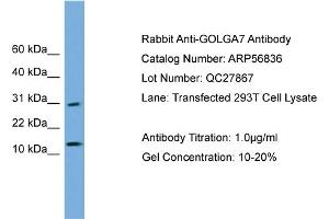WB Suggested Anti-GOLGA7  Antibody Titration: 0. (Golgin A7 antibody  (N-Term))