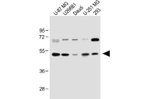 All lanes : Anti-WDR41 Antibody (C-term) at 1:1000 dilution Lane 1: U-87 MG whole cell lysate Lane 2: U266B1 whole cell lysate Lane 3: Daudi whole cell lysate Lane 4: U-251 MG whole cell lysate Lane 5: 293 whole cell lysate Lysates/proteins at 20 μg per lane. (WDR41 antibody  (C-Term))