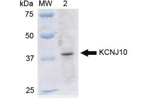Western blot analysis of Rat Liver cell lysates showing detection of ~42. (KCNJ10 antibody  (PE))