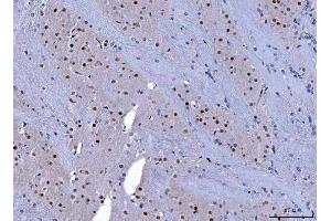 IHC analysis of CHD1 using anti-CHD1 antibody (ABIN7602361).