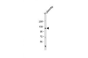 Western Blot at 1:1000 dilution + human placenta lysate Lysates/proteins at 20 ug per lane. (ADAM19 antibody  (AA 207-236))