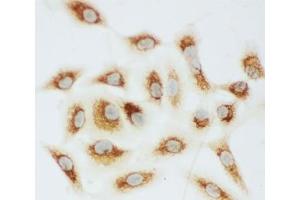 ICC testing of Cytochrome C antibody and A549 cells (Cytochrome C antibody  (AA 91-105))