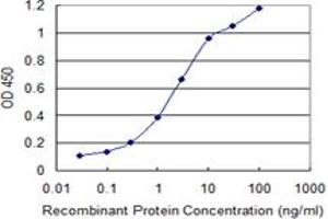 Detection limit for recombinant GST tagged MAGEB6 is 0. (MAGEB6 antibody  (AA 135-244))