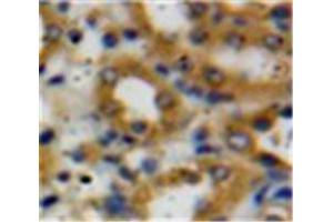 Used in DAB staining on fromalin fixed paraffin-embedded Kidney tissue (Decorin antibody  (AA 31-359))