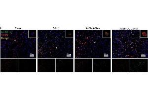 Autophagy of mice brain and neuron with the administration of COG1410. (LC3B antibody)