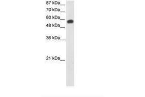 Image no. 2 for anti-Nucleolar Complex Associated 4 Homolog (NOC4L) (AA 401-450) antibody (ABIN6736234) (NOC4L antibody  (AA 401-450))