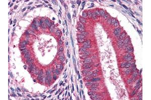 Immunohistochemical analysis of paraffin-embedded human Uterus tissues using anFtEG mouse mAb (EGF antibody)