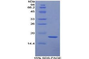 SDS-PAGE analysis of Human TFPI Protein. (TFPI Protein)