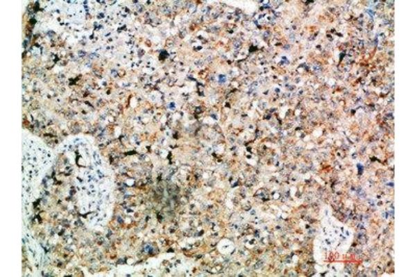 LAMP3 antibody  (AA 261-310)