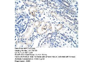 Human kidney (c-MYC antibody  (N-Term))