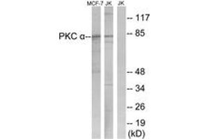 Western Blotting (WB) image for anti-Protein Kinase C, alpha (PKCa) (AA 623-672) antibody (ABIN2888770) (PKC alpha antibody  (AA 623-672))