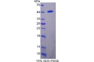 Image no. 1 for Transmembrane Protease, serine 4 (TMPRSS4) (AA 54-437) protein (His tag) (ABIN4990467)