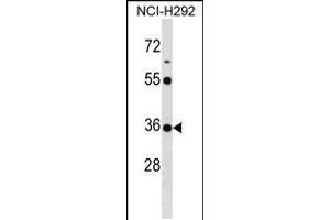 Western blot analysis in NCI-H292 cell line lysates (35ug/lane). (KCTD17 antibody  (AA 107-136))