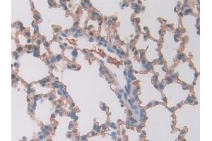 Immunohistochemistry (IHC) image for anti-Carbonic Anhydrase II (CA2) (AA 1-260) antibody (ABIN7438433)